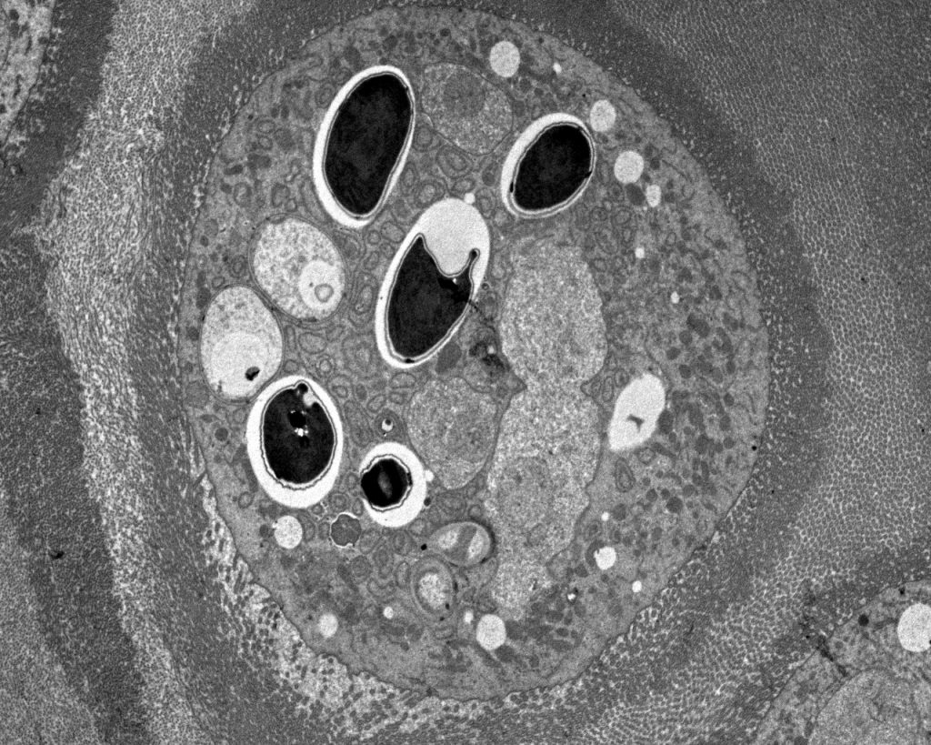 Célula epitelial del ventrículo de una abeja parasitada por Nosema ceranae. Fotografía cortesía de Mariano Higes© Artículo de la sección de Micología animal de la AEM.