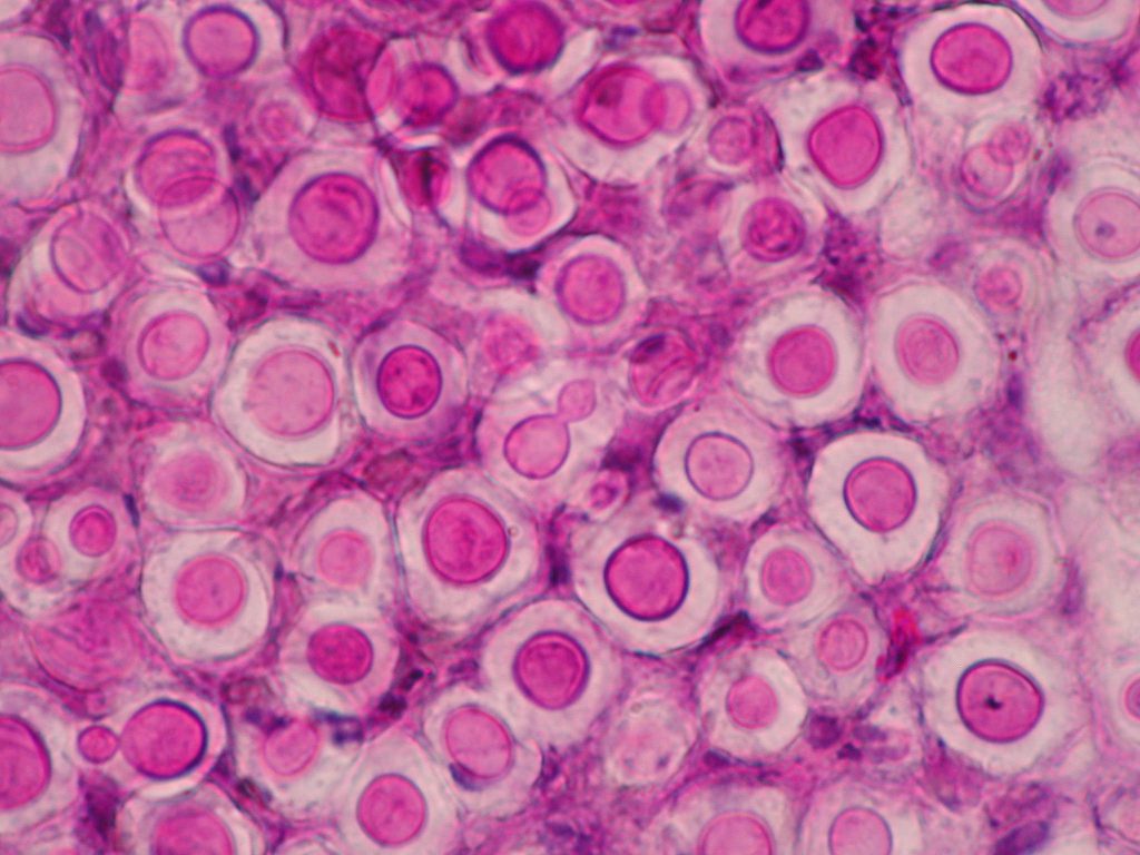 Numerosas células de  C. neoformans en una impronta de un nódulo subcutáneo de un perro con criptococosis. Tinción de PAS. Micología animal. Animal Mycology AEM.